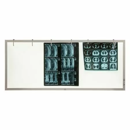 Негатоскоп TAGLER НСД-3 3-кадровый светодиодный Негатоскоп TAGLER НСД-3 3-кадровый светодиодный