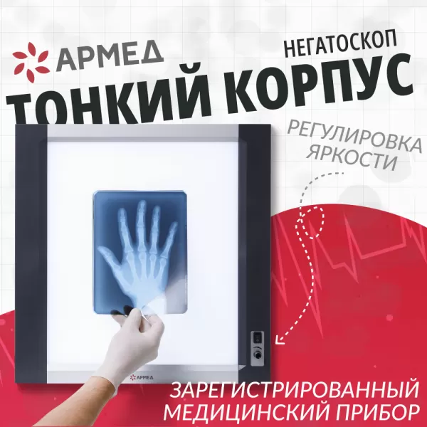 Негатоскоп общего назначения Армед 1-кадровый LUX Негатоскоп общего назначения Армед 1-кадровый LUX